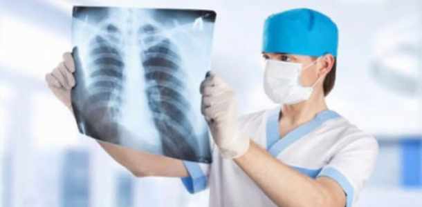 Tüdőszűrés Abonyban